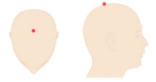 Dibujo con localización punto acupuntura Baihui para insomnio Centra Dra. LU en Barcelona