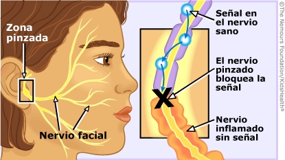 Imagen recorrido nervio facial inflamado con pinzamiento Paralisis de Bell Centro Acupuntura Dra. LU en Barcelona